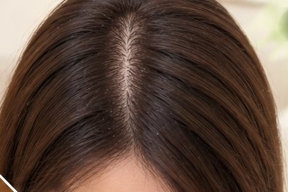 织发(男 · 女) · Hair Weaving (men & women)
